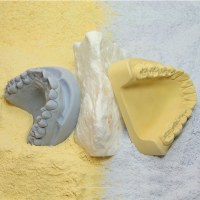 Modelit - blau - 25,0 kg Karton
